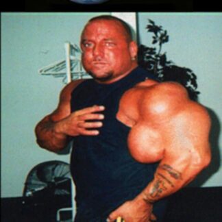 The Man Whose Arms Exploded (2005) DVD